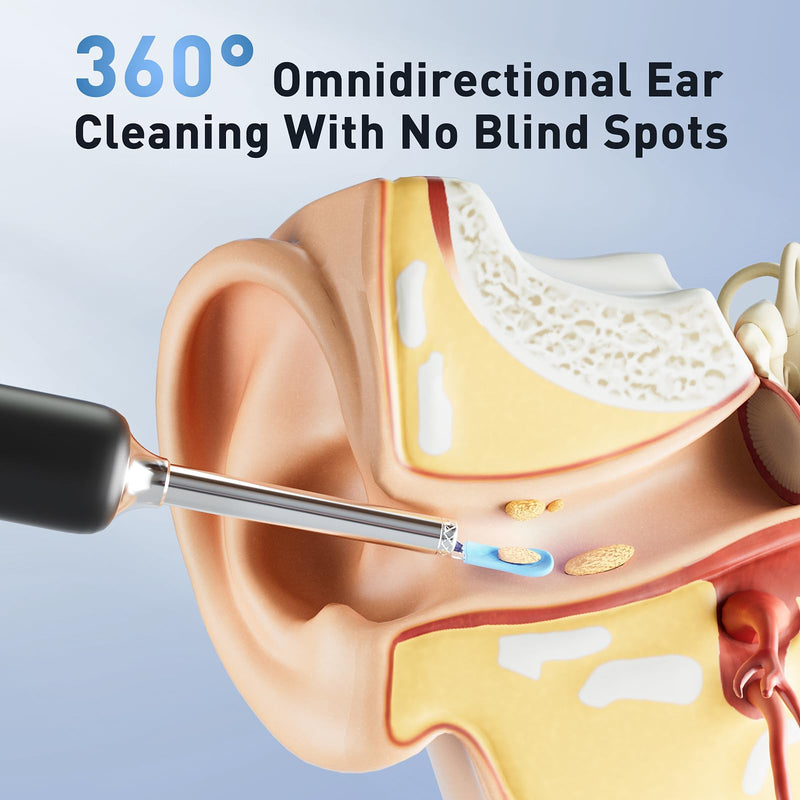 Ear Wax Removal - Electric Ear Irrigation Flushing System with 4 Pressure Modes, Ear Cleaner with Camera, 1080P Otoscope, Ear Cleaning Tool with 7 Pcs Ear Set, Safe and Effective Earwax Removal Kit Black