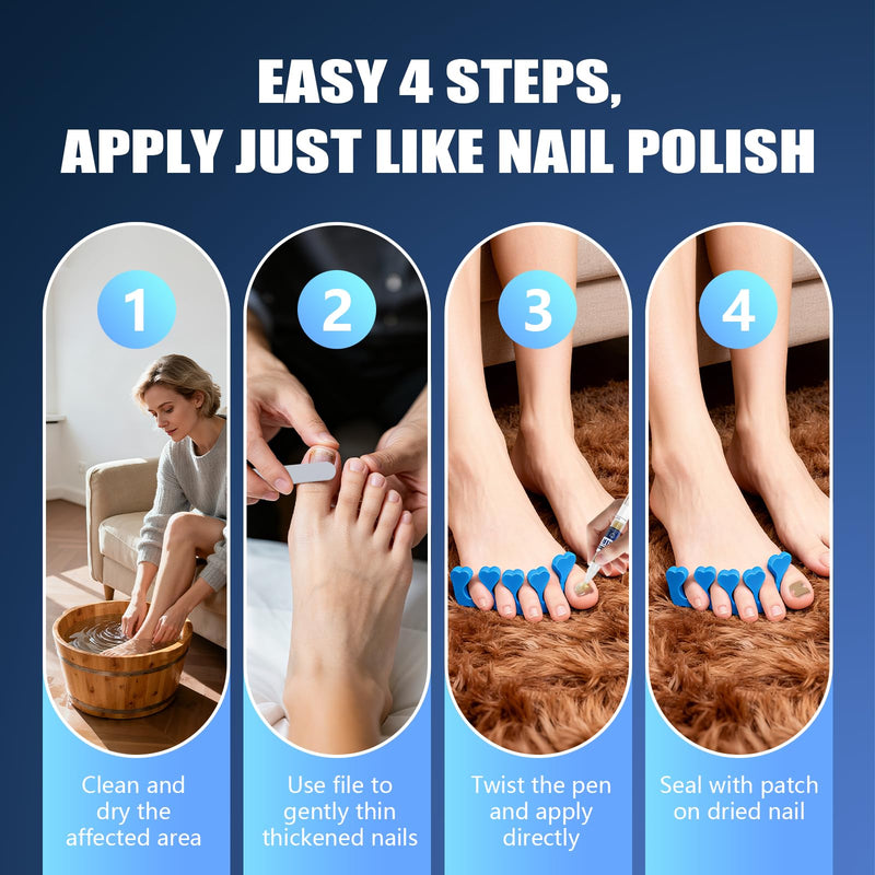 Toenail Fungus Pen – 25% Undecylenic Acid, Toenail Fungus Treatment Extra Strength, Nail Fungus Treatment Pen for Toenail & Finger, 5 x 3ml, Complete Care Kit with Nail Tools