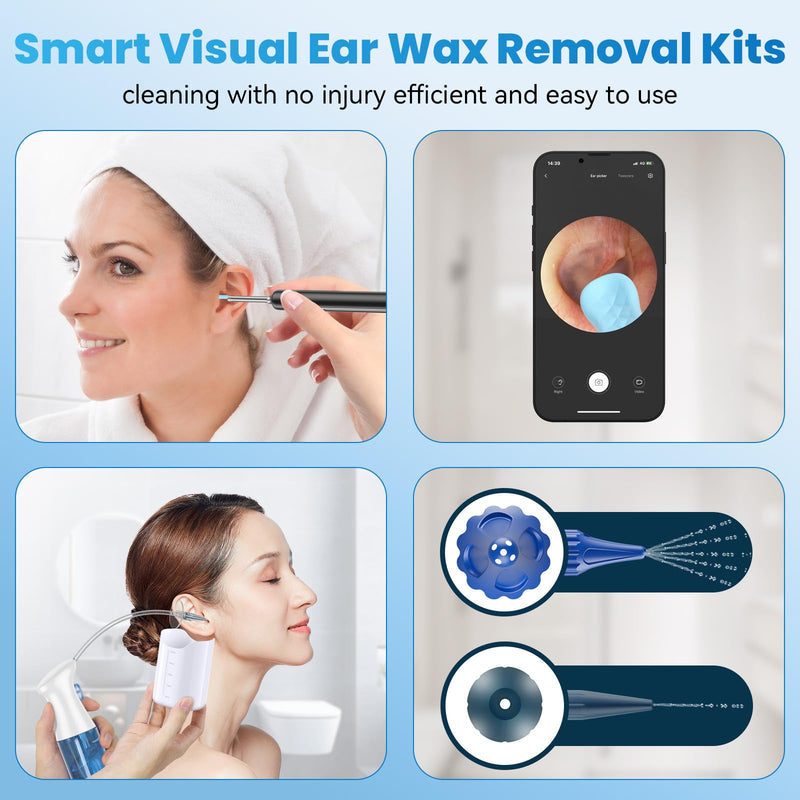 Ear Wax Removal - Ear Cleaner - Ear Camera - FSA HSA Eligible - Ear Wax Removal Kit - Ear Wax Removal Tool Camera - 1080HD Effective for Cleaning Ear Wax Build-Up - BeesActive Australia