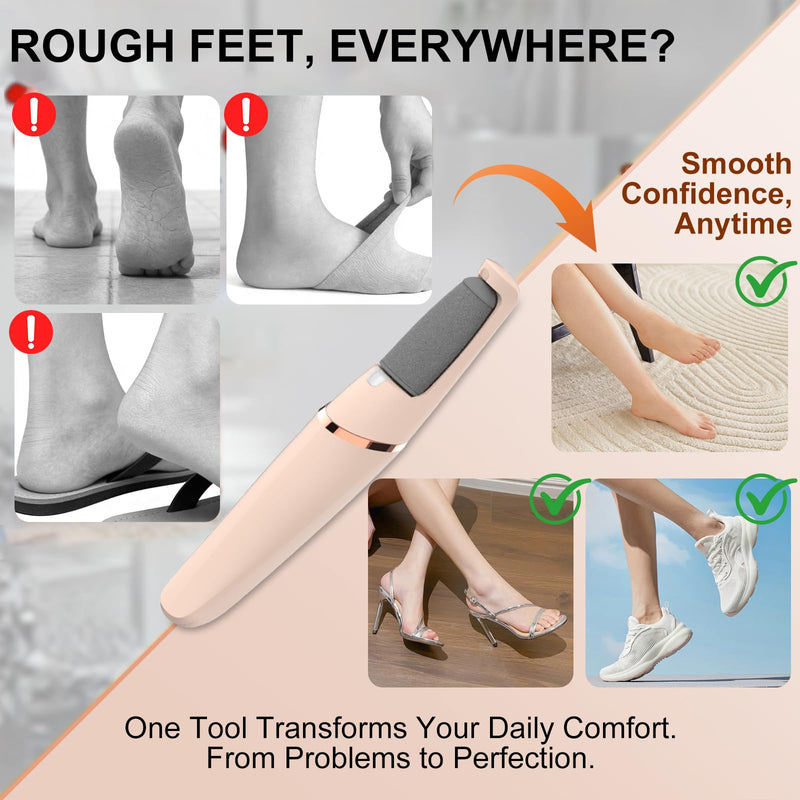 Electric Foot File, Callus Remover for Feet,Rechargeable Foot Pedicure Tool for Dry &Dead Cracked Skin,Professional Cordless Hard Skin Removal with 2 Durable Heads - BeesActive Australia