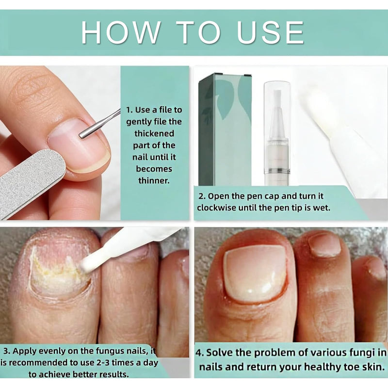 Toenail Fungus Treatment Extra Strength, Nail Repair for Damaged Nails with 25% Undecylenic Acid & Tolnaftate, Fungal Treatment for Toenails & Fingernails