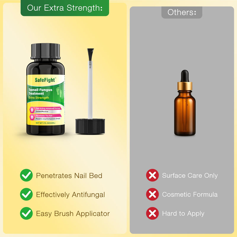 Toenail Fungus Treatment with 25% Undecylenic Acid & Tolnaftate - SafeFight Nail Repair Solution for Fungi Nail, Toenail Fungus Treatment Extra Strength Nail Repair for Fungi Nail 30ml - BeesActive Australia