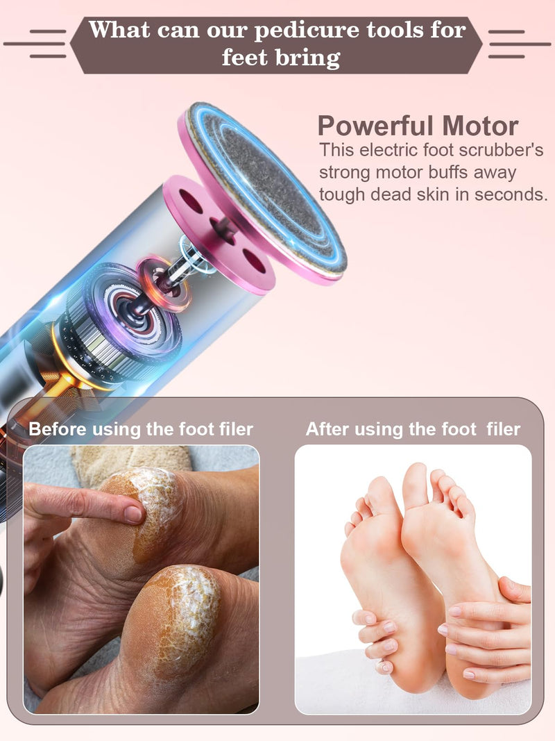 Electric Foot Callus Remover for Feet - Heavy Duty Pedicure Tool w/ 60 Grinding Discs Dead Skin Remover (Pink) Pink White - BeesActive Australia