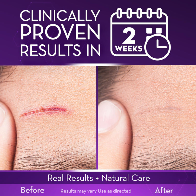 Cicatricure Advanced Scar Gel for Face & Body - Proven Results in 2 Weeks, Scar Treatment for Surgical Scars, Stretch Marks, Scars of Burns and Injuries, Acne Scar Treatment, 1 oz (28 g) - Pack of 2 (Pack of 2)
