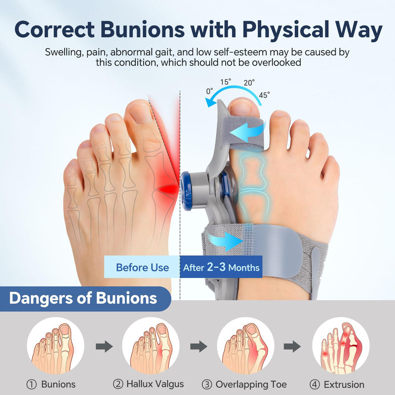 Bunion Corrector for Women & Men – Single Toe Straightener with Adjustable Alignment Knob & Silicone Pad, Day & Night Use, Fits Left or Right Foot