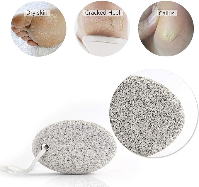 Phogary 2 Piece Natural Pumice Stone for Feet Lava Rock Pedicure Tool for Feet and Hands Hard Skin Exfoliating - Natural Foot File Exfoliating Remove Dead Skin - BeesActive Australia