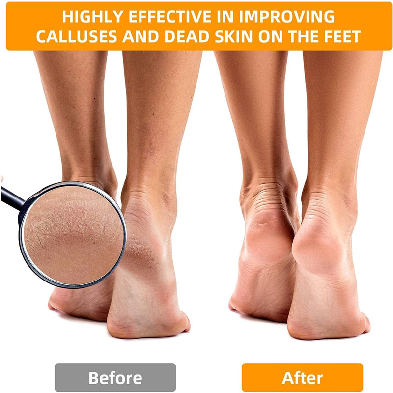 12 Pack Foot File Callus Remover Replacement: Stainless Steel Foot Rasp for Feet Detachable Foot Scrubber Pedicure Tools Hard Skin Remove Big Hole for Wet and Dry Feet Silver 1 Count (Pack of 12) - BeesActive Australia