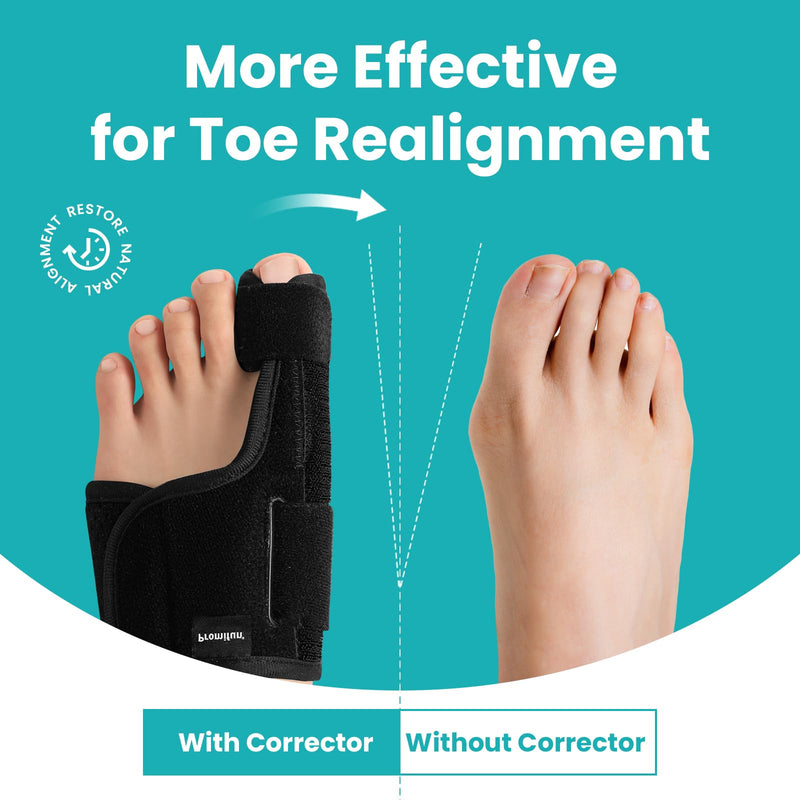 Promifun Toe Splint for Broken Toes - Big Toe Splint for Women & Men - Support Brace for Day & Night Use - Bunion Corrector - 1 Pair Gel Spacer