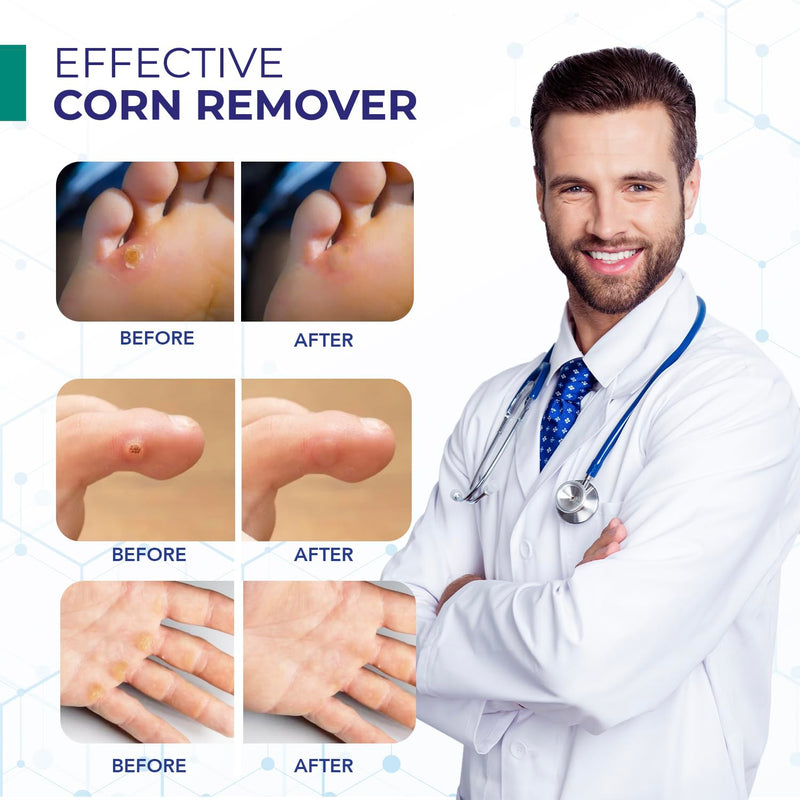 Corn Removers for Toes: Liquid Salicylic Acid Corn Removal for Feet - Corn Callus Remover for Feet Extra Strength (1ml) - BeesActive Australia