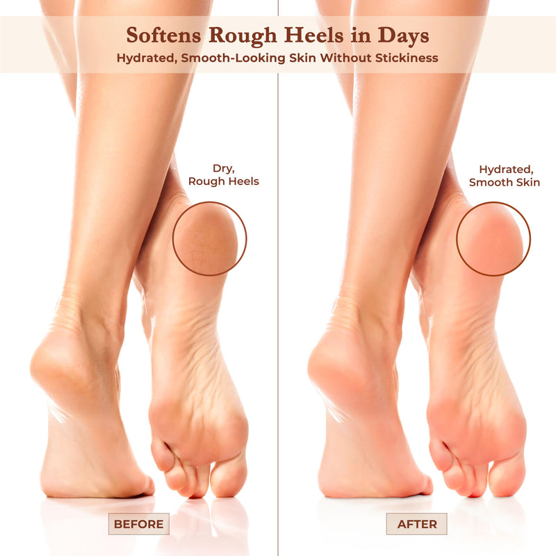 Foot Cream for Dry Cracked Heels and Feet Moisturizer with Argan Oil, Shea Butter & Vitamin E – Hydrating Foot Lotion for Dry Cracked Feet for Women – Smooth, Fast-Absorbing, Non-Sticky Care - BeesActive Australia