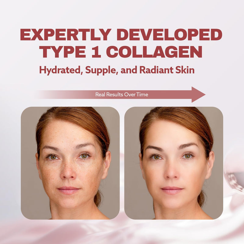 ILO Liquid Collagen Drink, 3000mg Type 1 Marine Collagen, 14 Bottles | 500 Dalton orange shots with biotin, ceramide, hyaluronic acid, vitamin C & Beau-mino Complex - no powder, no fishy taste 0.85 Fl Oz (Pack of 14)