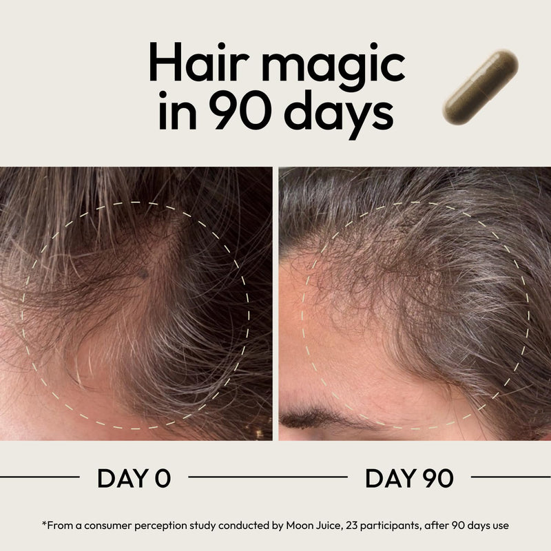 Moon Juice, SuperHair Growth Vitamins, Biotin & Saw Palmetto, 120ct | Clinical strength multivitamin for thicker, stronger strands, women & men, 30 servings Bottle