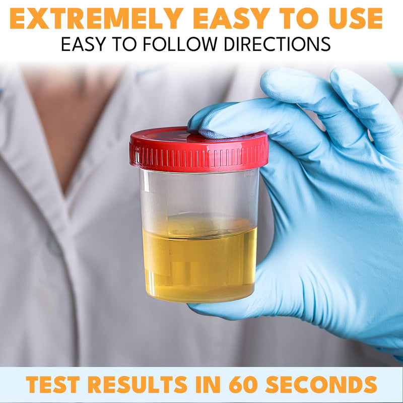 14-URS Reagent Test Strips [120 ct] for Urinalysis and Detection of UTI, LEK, Pro, Ket and More, Comprehensive Test - for Men & Women at Home Use with Reliable Results in 60 sec.