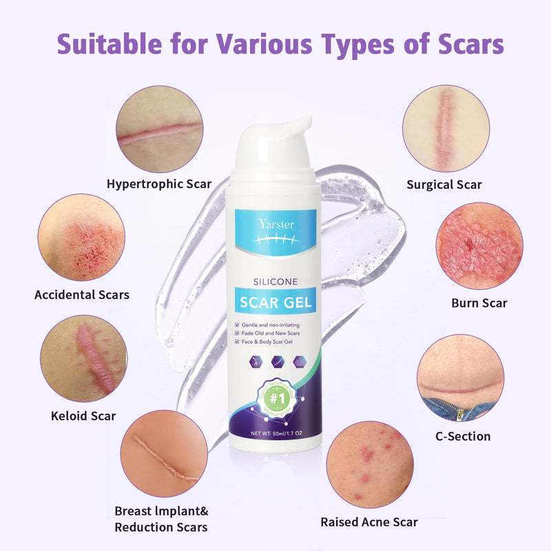Silicone Scar Gel Scar Cream, Treats Old and New Scars, Stretch Marks Removal Formula Helps from Surgical, Burns, Acne Scar Treatment with Advanced Scar Gel, 1.7 oz (50ml) 1.7 Ounce