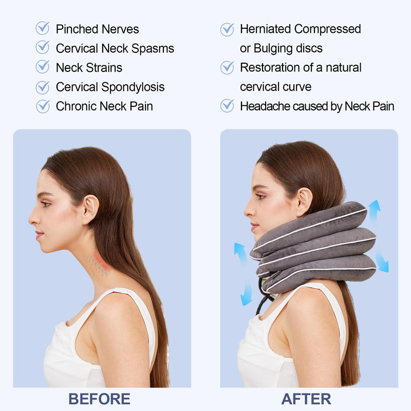 Neck Stretcher for Pain Relief, Adjustable Inflatable Cervical Traction Device, Neck Brace for Home Use, Supports Neck Decompression & Spine AlignmentÔºåGifts for Women (Grey) Grey - BeesActive Australia