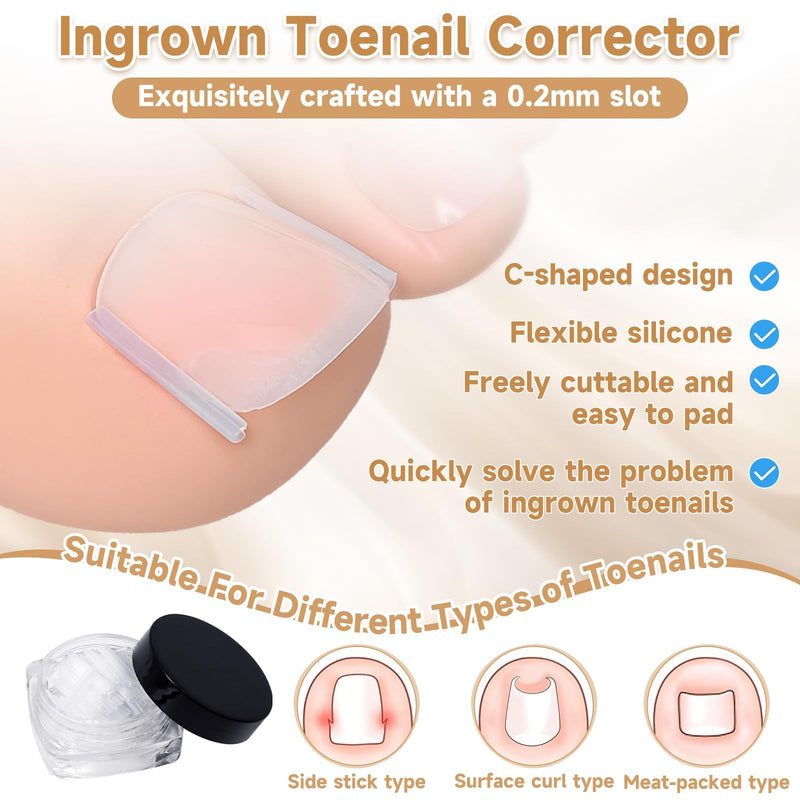 201 Pcs Ingrown Toenail Corrector Kit with Breathable Correction Strips, Curved Nail Patches, Toenail Lifter Tools, Complete Home Pedicure Set for Daily Nail Grooming & Nail Shaping