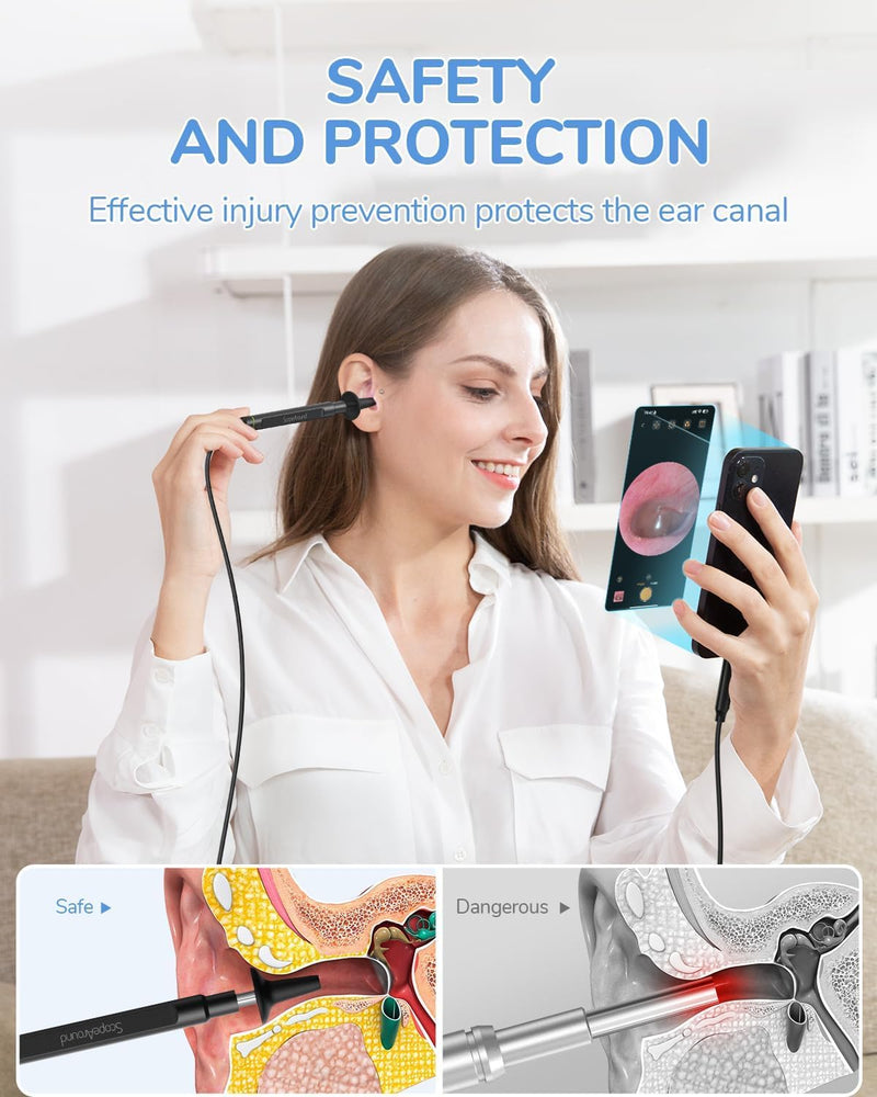 ScopeAround Otoscope with Light, 1080P FHD Ear Scope, 3.9mm Digital Otoscope Camera with 6 LED Lights Ear Wax Removal Tool Camera, Ear Scope with Light, Compatible with USB-C - BeesActive Australia