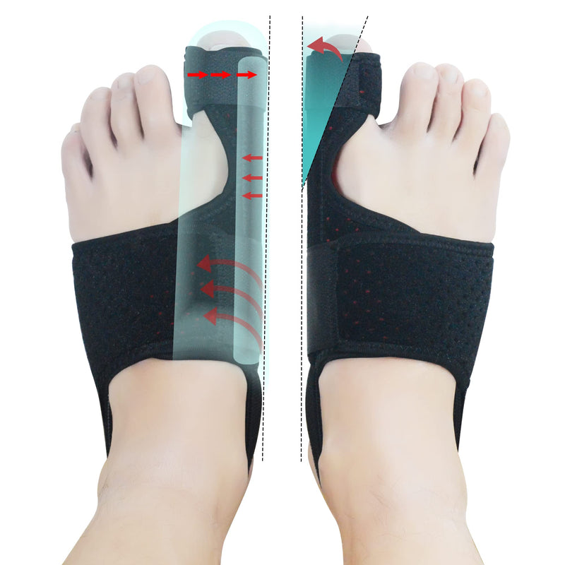 MOONSMILE Bunion Corrector for Women & Men (Black/Red)