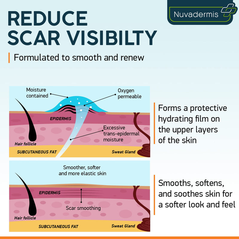 NUVADERMIS Silicone Scar Sheets & Scar Cream Gel - C-Section, Tummy Tuck, Keloid, Acne Removal Treatment - Advanced Post Surgery Supplies - Scars Removal Treatment - BeesActive Australia