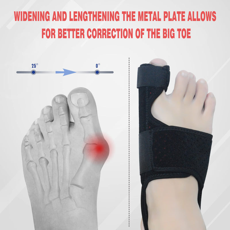 MOONSMILE Bunion Corrector for Women & Men (Black/Red)