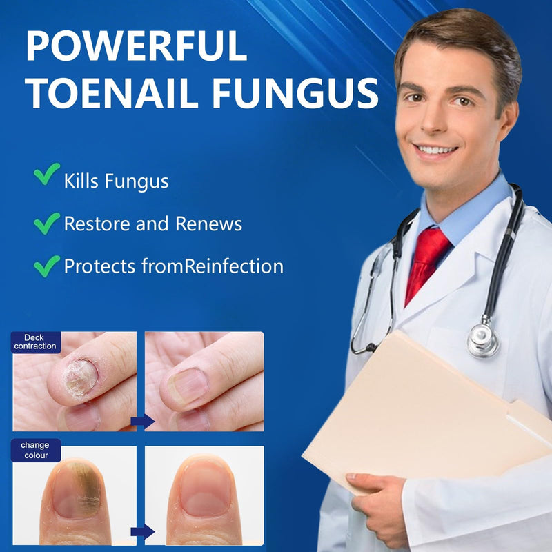 Toenail Fungus Treatment Extra Strength, 30ML Fungus Nail Repair Liquid with 1% Tolnaftate, Fast Acting Treatment for Discolored & Damaged Nails, Athletes Foot 1 Fl Oz (Pack of 1)