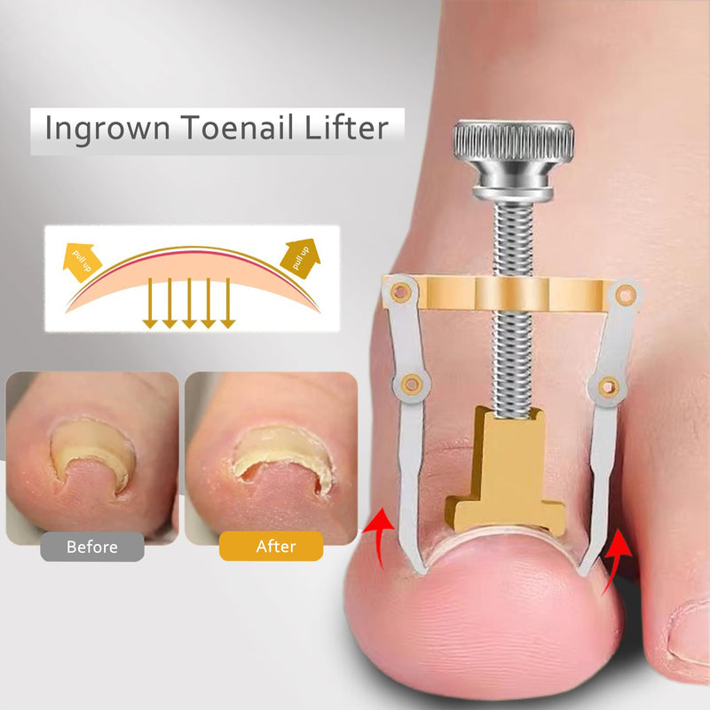Ingrown Toenail Clipper for Men Women Nail Clipper for Senior Thick Toenail Clippers for Ingrown Nails Removal Set Nail Cutter Pedicure Knife Toe Nails Clipper Kit Classic A-7 - BeesActive Australia