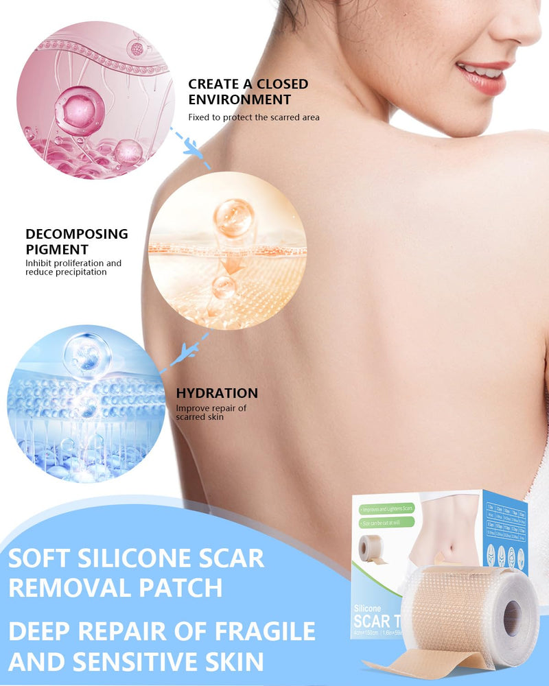 Silicone Scar Sheets, Silicone Scar Tape, 1.6‚Äùx60‚Äù Roll, Scar Removal Treatment, Medical Grade Scar Tape for Surgical, C-Section, Burn Scars (1.5M) 1.5M - BeesActive Australia