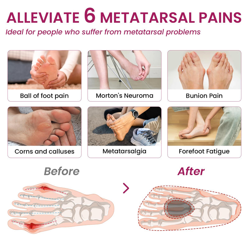 4-Pair Metatarsal Pads for Pain Relief - Bukihome Ball-of-Foot Cushions for Forefoot Support Fatigue Relief, 1/3" Thick Soft Ball-of-Foot Pads for Metatarsalgia Morton’s Neuroma, Men Women (L) Black 4 Pairs - L(Men's 10.5-13)