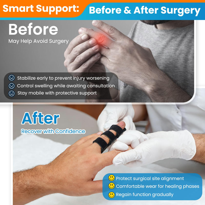 Trigger Finger Splints - (2+2 Set) Finger Ice Pack for Pain Relief, Straightening Arthritis, Sprain, Injured Mallet Finger - Finger Brace for Index, Middle, Ring, Thumb Finger One Size
