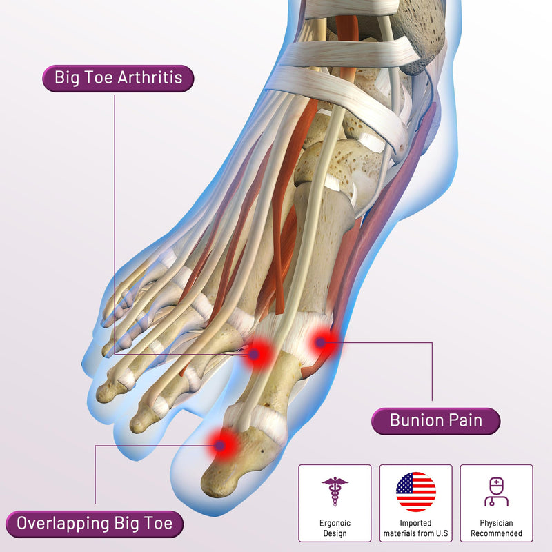 Bunion Corrector Sleeve, Breathable Bunion Big Toe Alignment Splint with Anti-Slip Heel Grip,4 Sizes,Extra Thick Gel Pads & Adjustable Straps for Hallux Valgus Comfort. (Black, XXS: WOMEN 4-3) Black