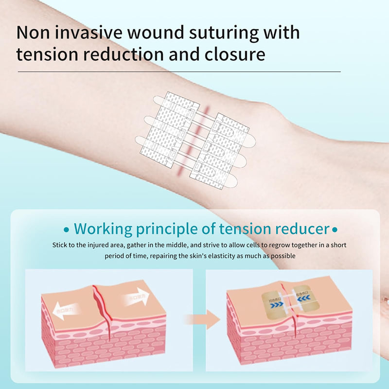Wound Closure Strips Zip Stitch Sutures Butterfly Bandaids Emergency Laceration Closure Kit for Lacerations Incisions Cuts(6X8CM) 6x8cm