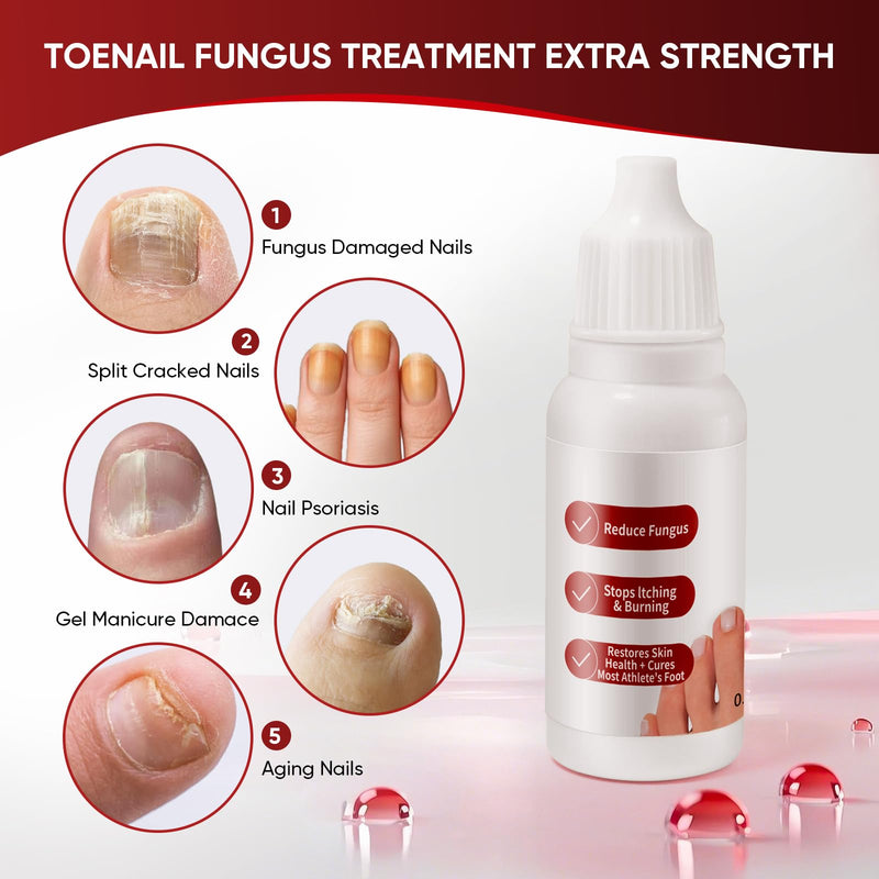Toenail Treatment,Gentle Formula, Effectively Improves Nails for a More Beautiful Appearance 0.5 Fl Oz (Pack of 2) - BeesActive Australia