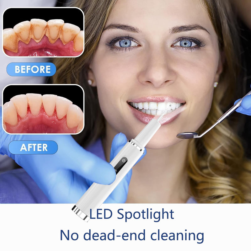 Professional Plaque Remover for Teeth, Teeth Cleaner Tool with Intelligent and Secure Sensor Technology, 4 Replaceable Heads 5 Modes, OLED Light & Oral Mirror, Rechargeable Teeth Cleaning Kit For Home - BeesActive Australia