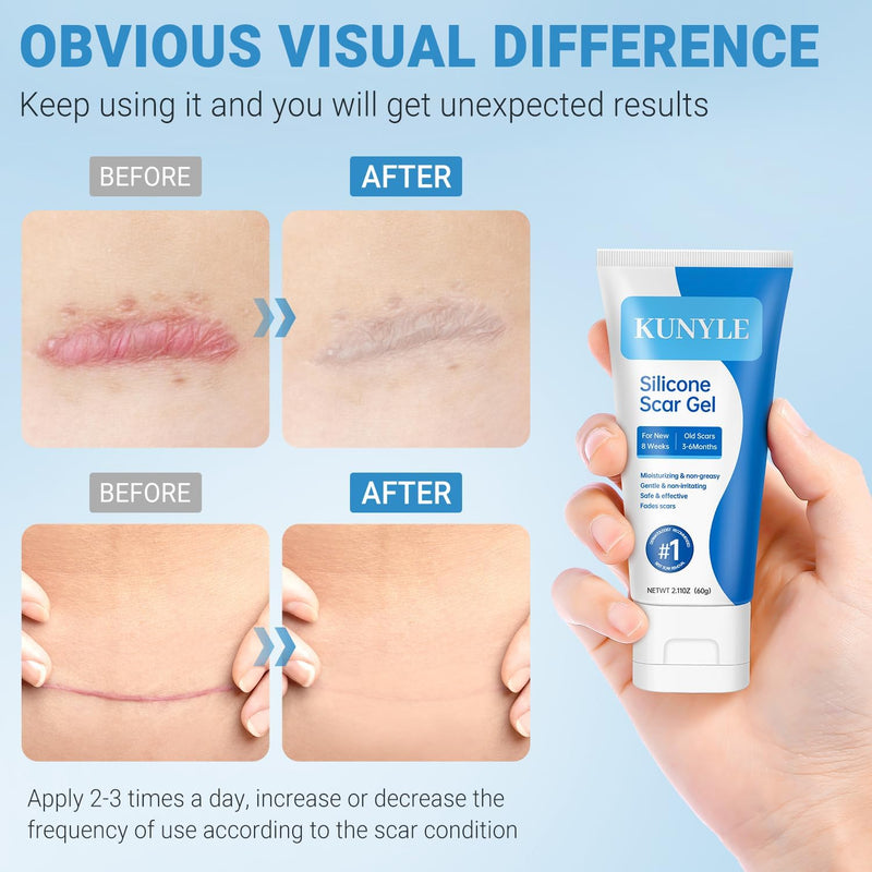 Silicone Scar Gel, Scar Cream, Advanced Scar Stick for Surgical Scars, Stretch Marks, Keloid Bump Removal, Old and New Scars 2.11oz (60g) 2.11 Ounce - BeesActive Australia