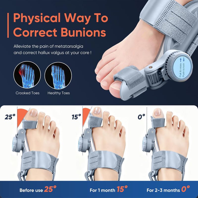Bunion Corrector for Women & Men, Adjustable Knob Dual-Action Bunion Splint with Silicone Pad - Orthopedic Toe Straightener & Separator for Hallux Valgus Relief, Fits Left/Right Feet (Gray) Gray