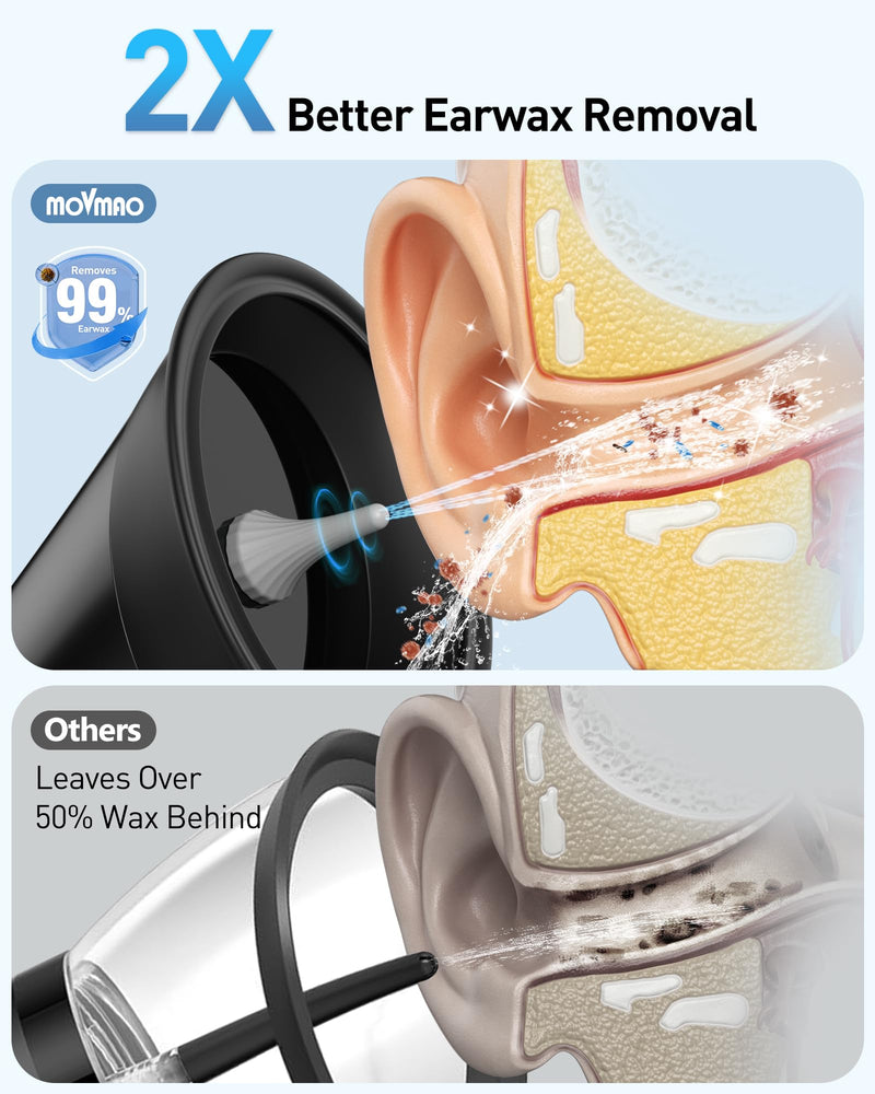 Ear Wax Removal, Electric Ear Cleaner with LED Display & Dual Tank, Ear Irrigation Kit Includes 12 Tips, IPX7, Safe & Effective Cleaning for Adults & Kids, Easy to Use Black