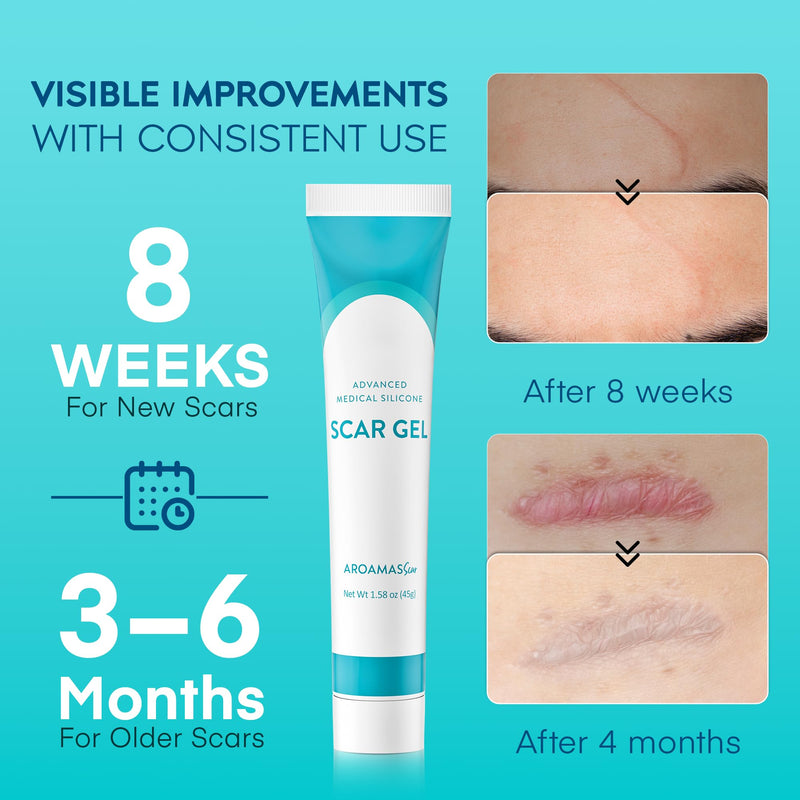 Aroamas Scar Advanced Scar Gel - Medical-Grade Silicone Scar Gel to Help Improve The Appearance of Scars and Stretch Marks for Face & Body - 45g - BeesActive Australia