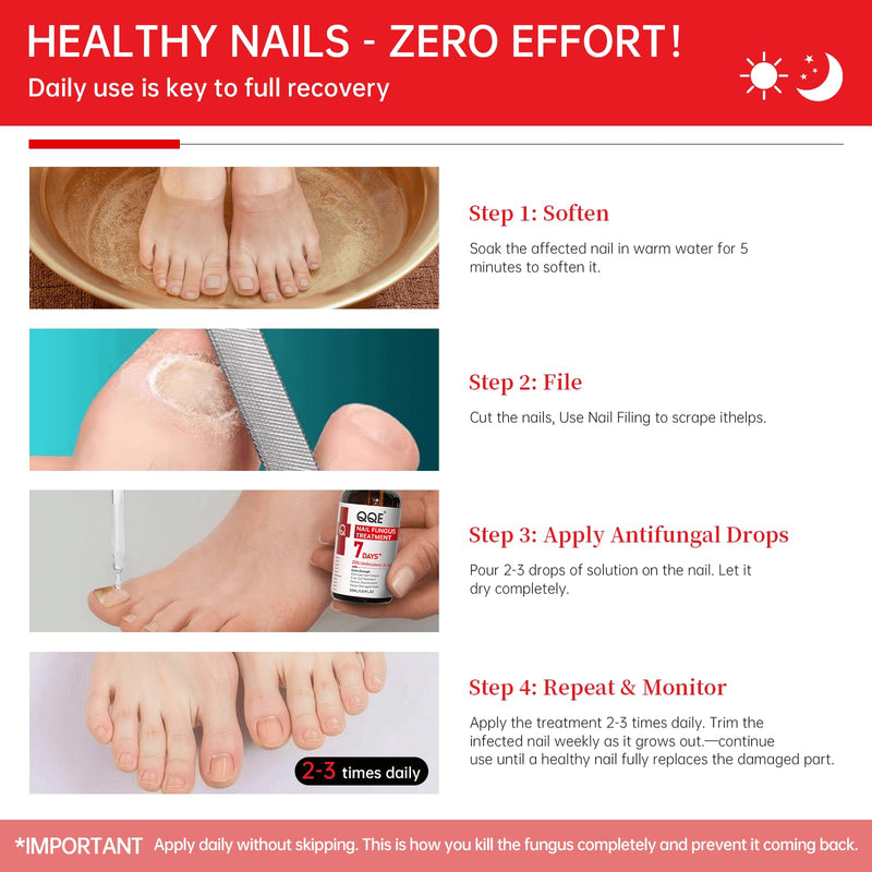 Nail Fungus Treatment Extra Strength - 25% Undecylenic Acid, Gentle Plant Formula for Fingernails, Treats Under & Around Nail, Treatment Discoloration, Repair Thick, Damaged Nails, 2.02Fl.oz 2.02 Fl Oz (Pack of 1)