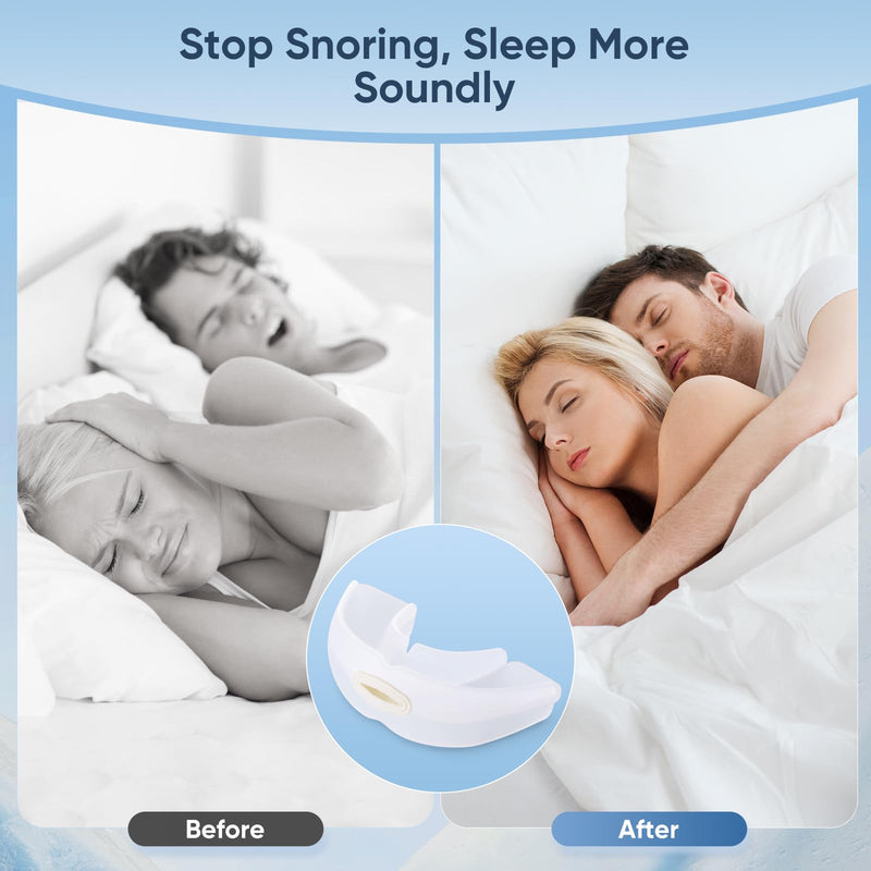 Anti-Snoring Device, Reusable Snore Stopper Anti Snoring Mouthpiece, Snoring Solution Mouthpiece Stop Snoring for Men and Women Green - BeesActive Australia