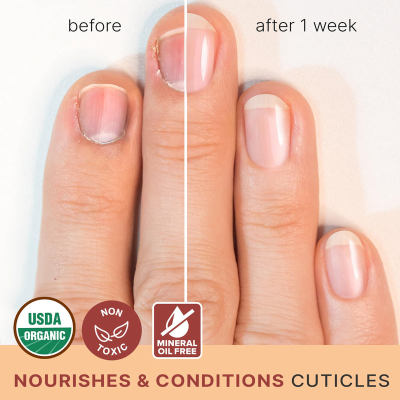 Organic Nail and Cuticle Oil - USA Made Nail Oil for Growth & Strength with Jojoba and Vitamin E, Repair for Damaged Nails & Cuticle Softener made with Natural Ingredients, Nails Care Products 0.7 Fl Oz (Pack of 1) - BeesActive Australia