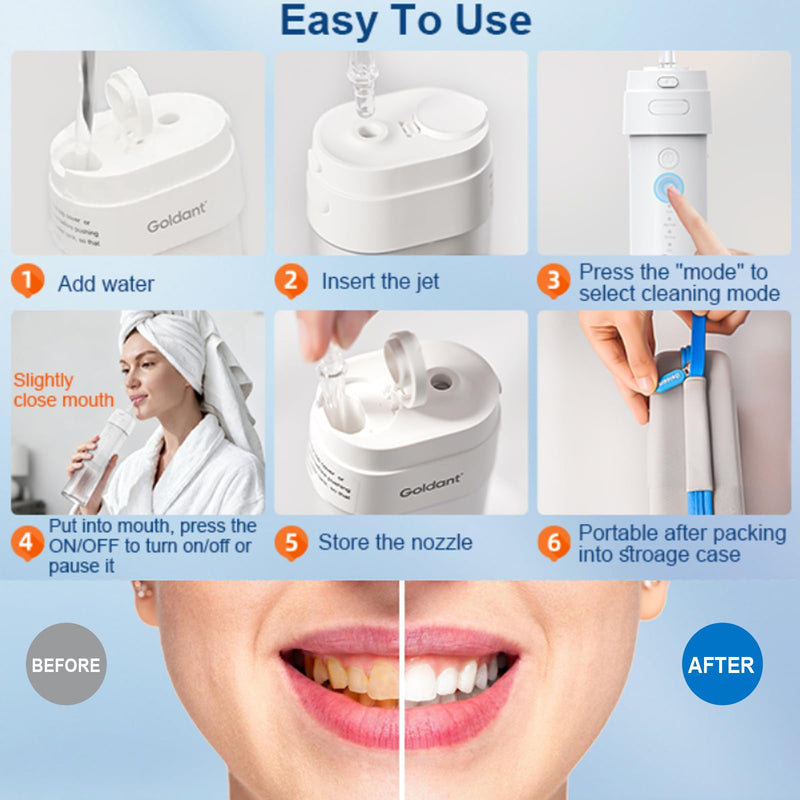 2026 New Portable Water Flosser for Teeth, 4 Modes & 4 Intensity Levels, Mini Small Design with Exquisite Travel Case, Removable Tank, IPX7 Waterproof, Cordless Dental Oral Irrigator (Black) Black - BeesActive Australia