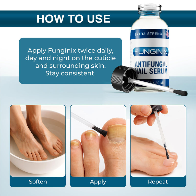 FUNGINIX Toenail Fungus Treatment Extra Strength - Antifungal Nail Treatment With 10% Undecylenic Acid & Tea Tree Oil - Includes Natural Oils & Botanicals - Made in USA (Packaging Does Vary) 1 Fl Oz (Pack of 1)