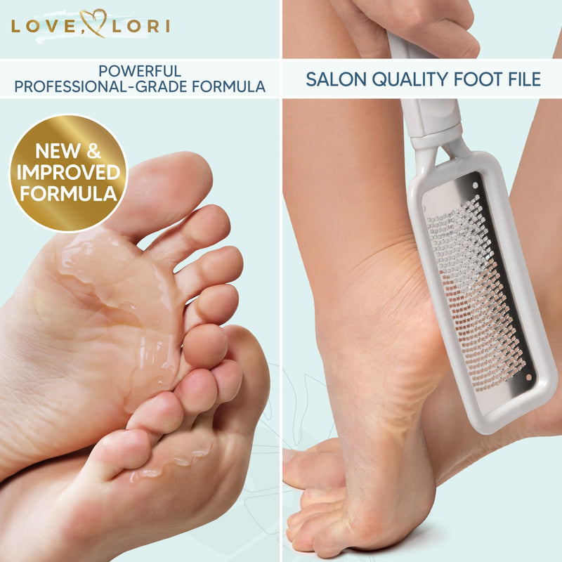Foot Callus Remover Kit - Foot File & Callus Gel Feet Scrubber Dead Skin Scraper Bundle, 6oz - BeesActive Australia