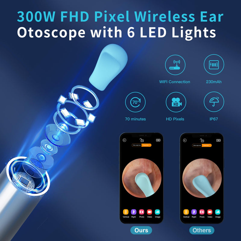 Ear Wax Removal, Ear Cleaner with HD Ear Camera, Wireless Ear Otoscope Earwax Remover Kit with 4 Ear Pick & 6 LED Lights, Ear Cleaning Tool for iOS & Android, White - BeesActive Australia