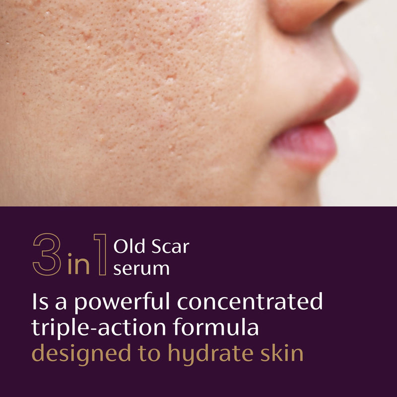 Mederma Scar Serum – Triple-Action Formula with Vitamin E, Hyaluronic Acid & Niacinamide – Clinically Shown to Reduce Old Scars, 1 Fl. Oz. - BeesActive Australia