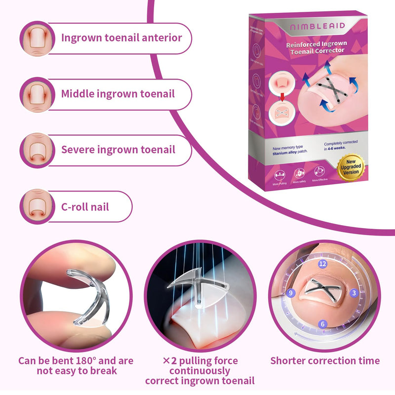 10 Patchs X-Shaped Upgrade Titanium Alloy Ingrown Toenail Corrector,At Home Ingrown Toenail Treatment for Man and Women,Ingrown Toenail Removal Kit,Curved Toenail Straightener (1 Count (Pack of 16)) 1 Count (Pack of 16)