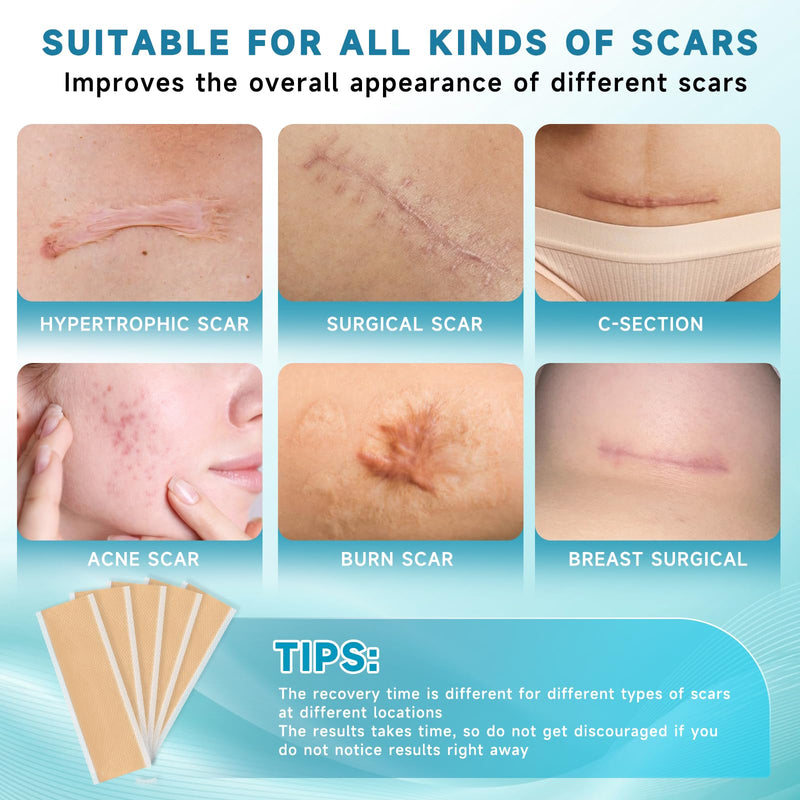 Rvlaim Medical Grade Silicone Scar Sheets (5.7" x 1.57"10 Pcs), Professional Silicone Scar Tape for Surgical C-Section, Keloid, Burn & Acne Scars - Reusable, Waterproof, Stickiness Upgrade 10 Pcs(5.7" x 1.57" ) - BeesActive Australia