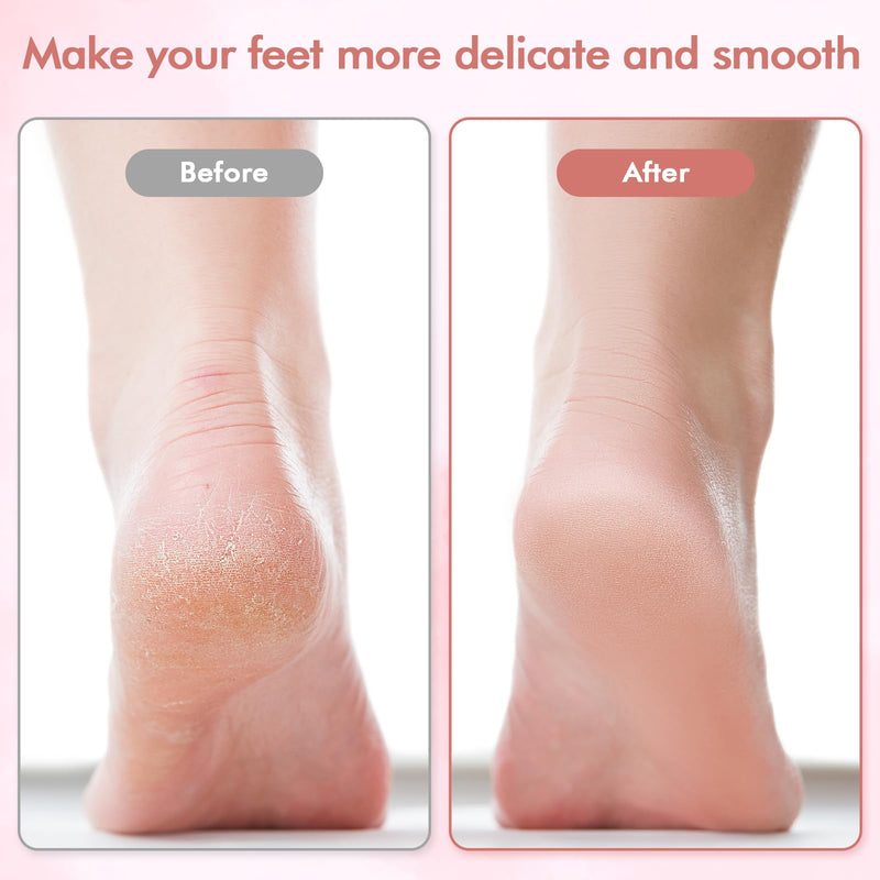 Electric Foot File and Callus Remover,Professional Pedicure Tools for Dry, Calluses, Dead, Cracked, Hard Skin,Equipped with 2 Grinding Heads and 1 Cleaning Brush - BeesActive Australia