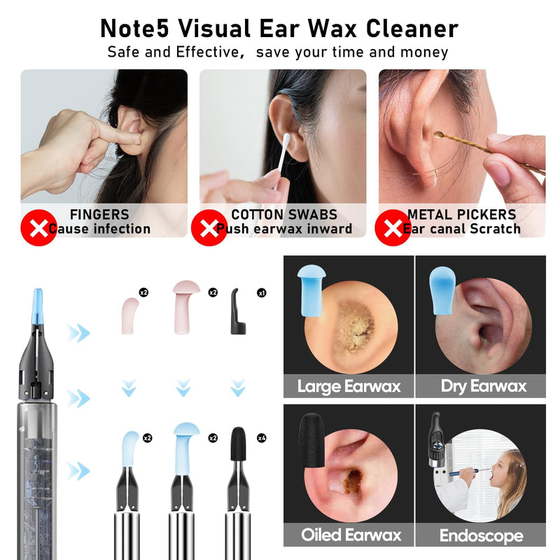 Note5 Ear Wax Removal Kit with Camera,10MP Ear Cleaner Camera Otoscope with Light,Real-time Remote Video with Ear Pick & Tweezers,12 Pcs Ear Scoops for Whole Family Update Ear Wax Tweezers - BeesActive Australia