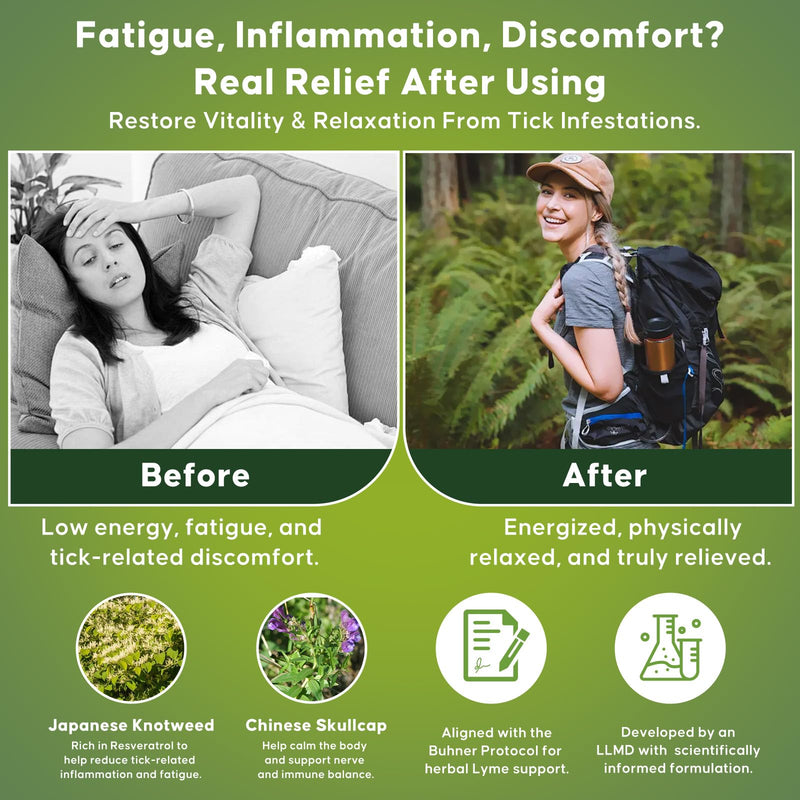 Tick Immune Support, Herbal Blend with Japanese Knotweed, Cat’s Claw, Chinese Skullcap, Cryptolepis, Supports Detox, Inflammatory Balance & Immune Strength, 90 Vegan Capsules, Non-GMO, Gluten